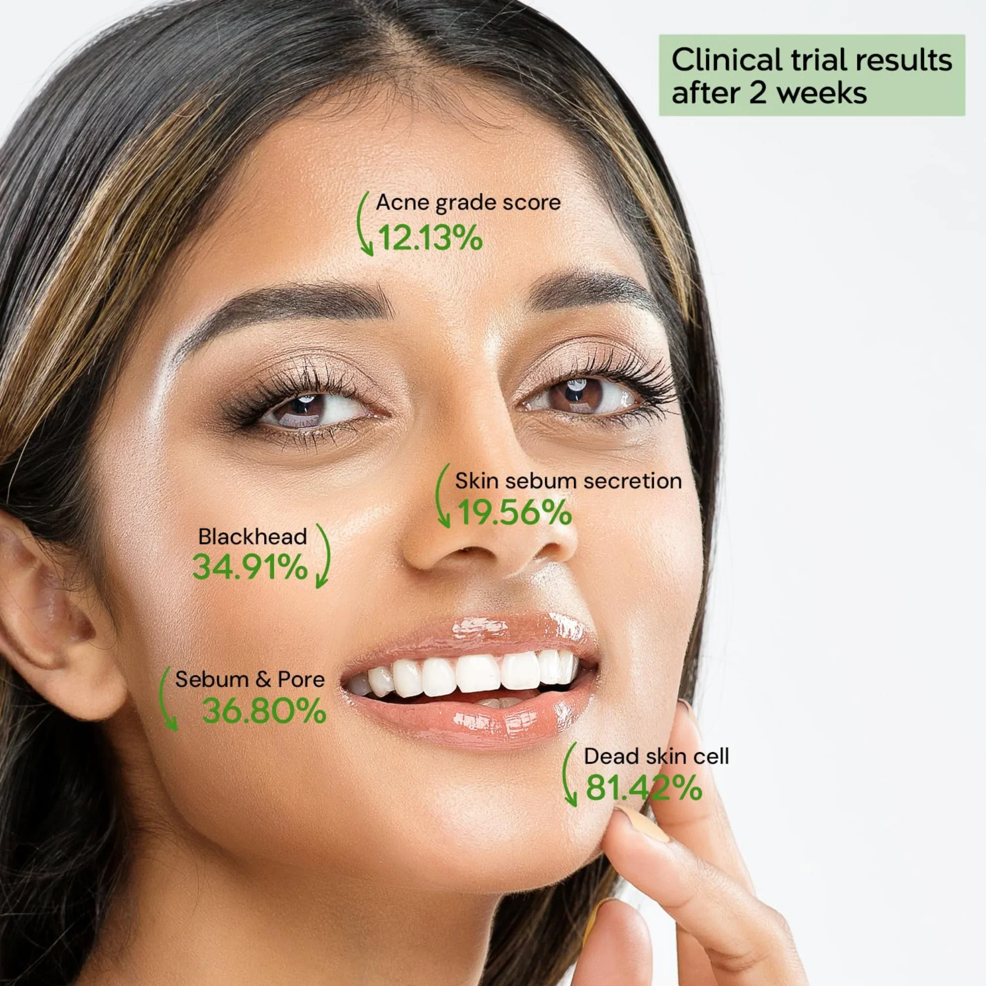 ThermoCeuticalDeACAcidermCream50ml_5_1024x1024@2x.webp