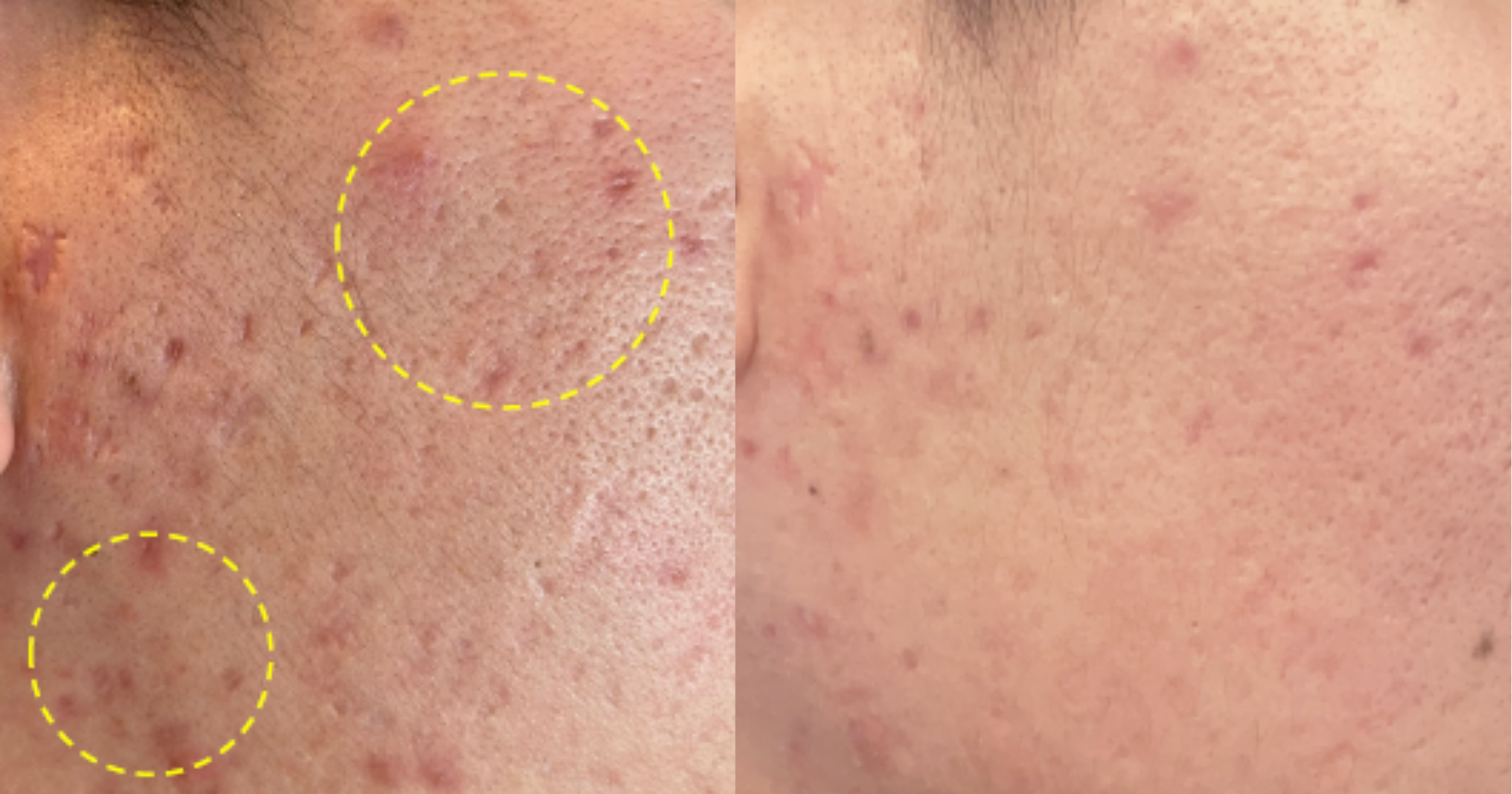 Before and After