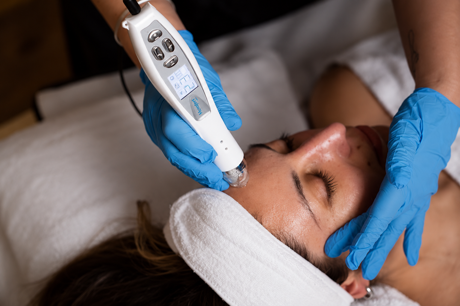 Lady on the beauty bed has a white headband on. Blue gloves show and a skin needling device is being used