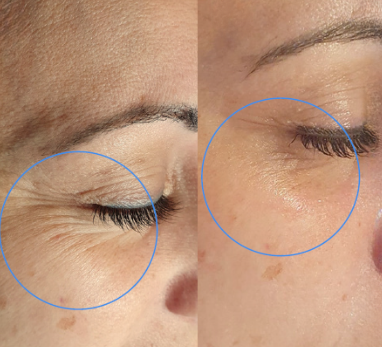 Before and After 2 Treatments 