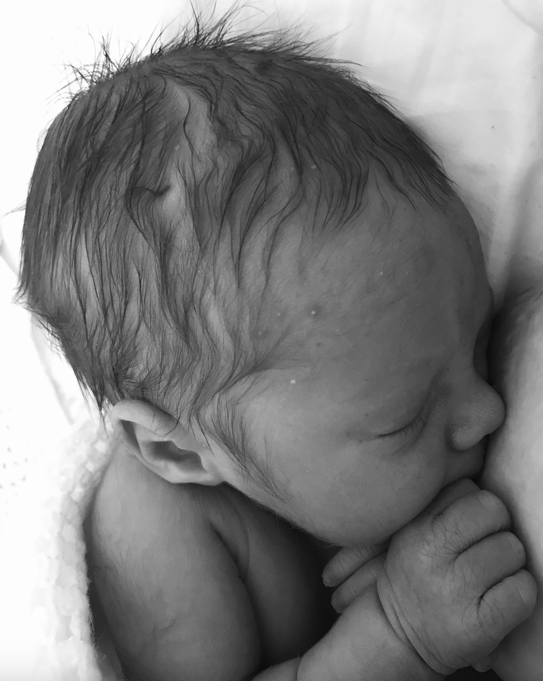 Baby Blues After Birth: Symptoms, Causes and When to Seek Help