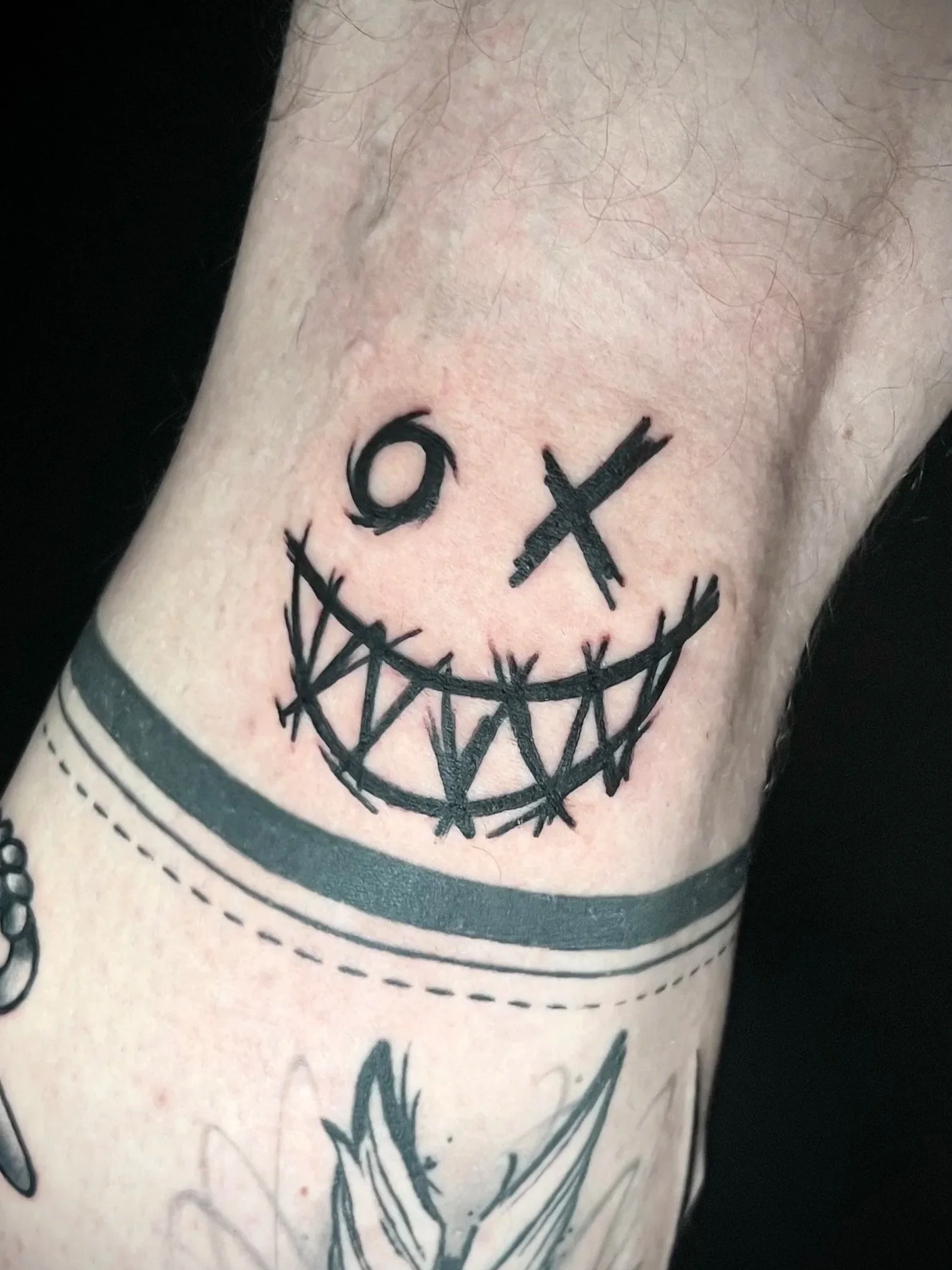 Tattoo eines Lächelnden Gesichts mit gesplitterten Zähnen, schwarzen Linien, auf einem behaarten Unterarm.