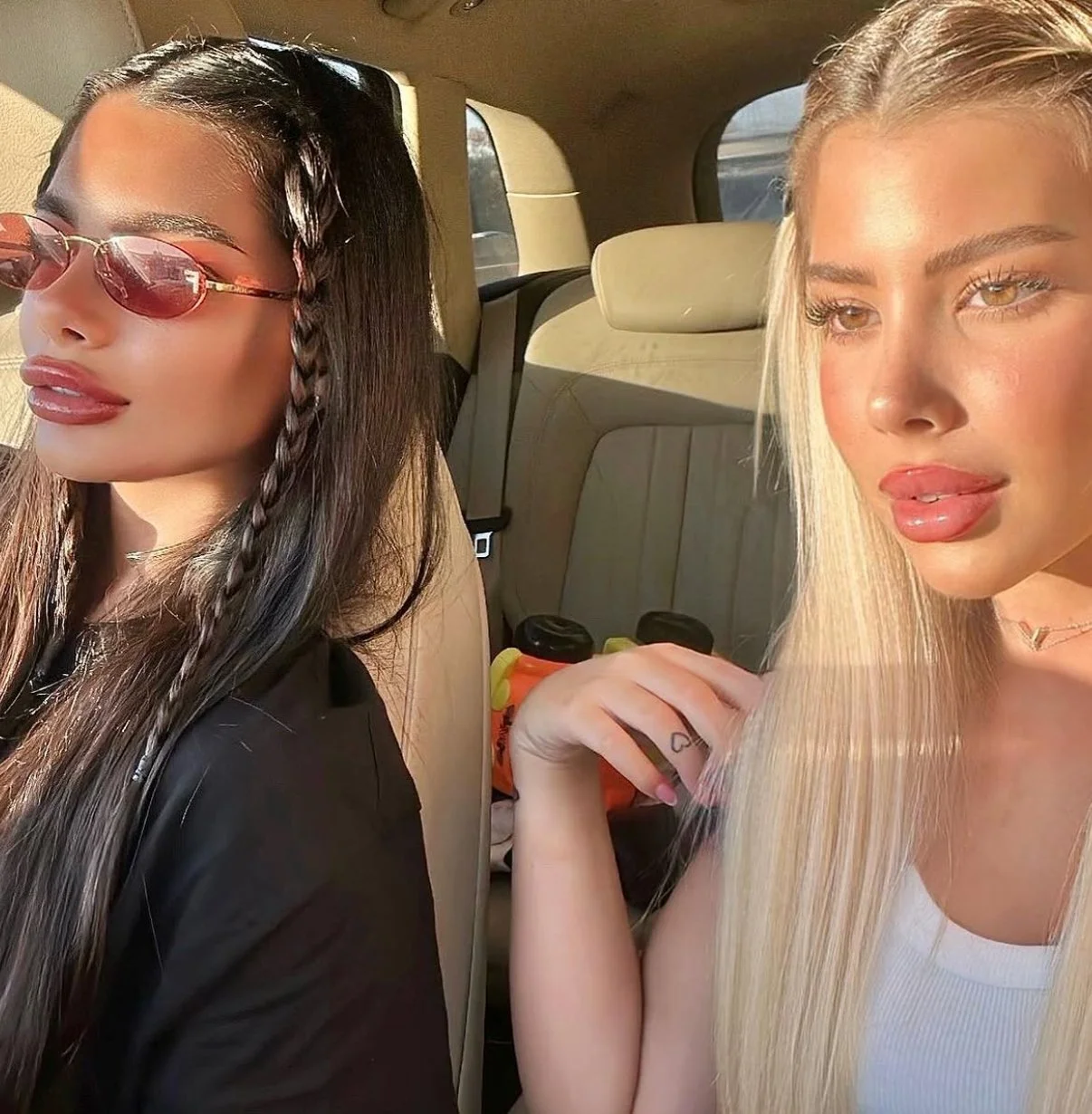 Before and after primary rhinoplasty revision rhinoplasty in Istanbul