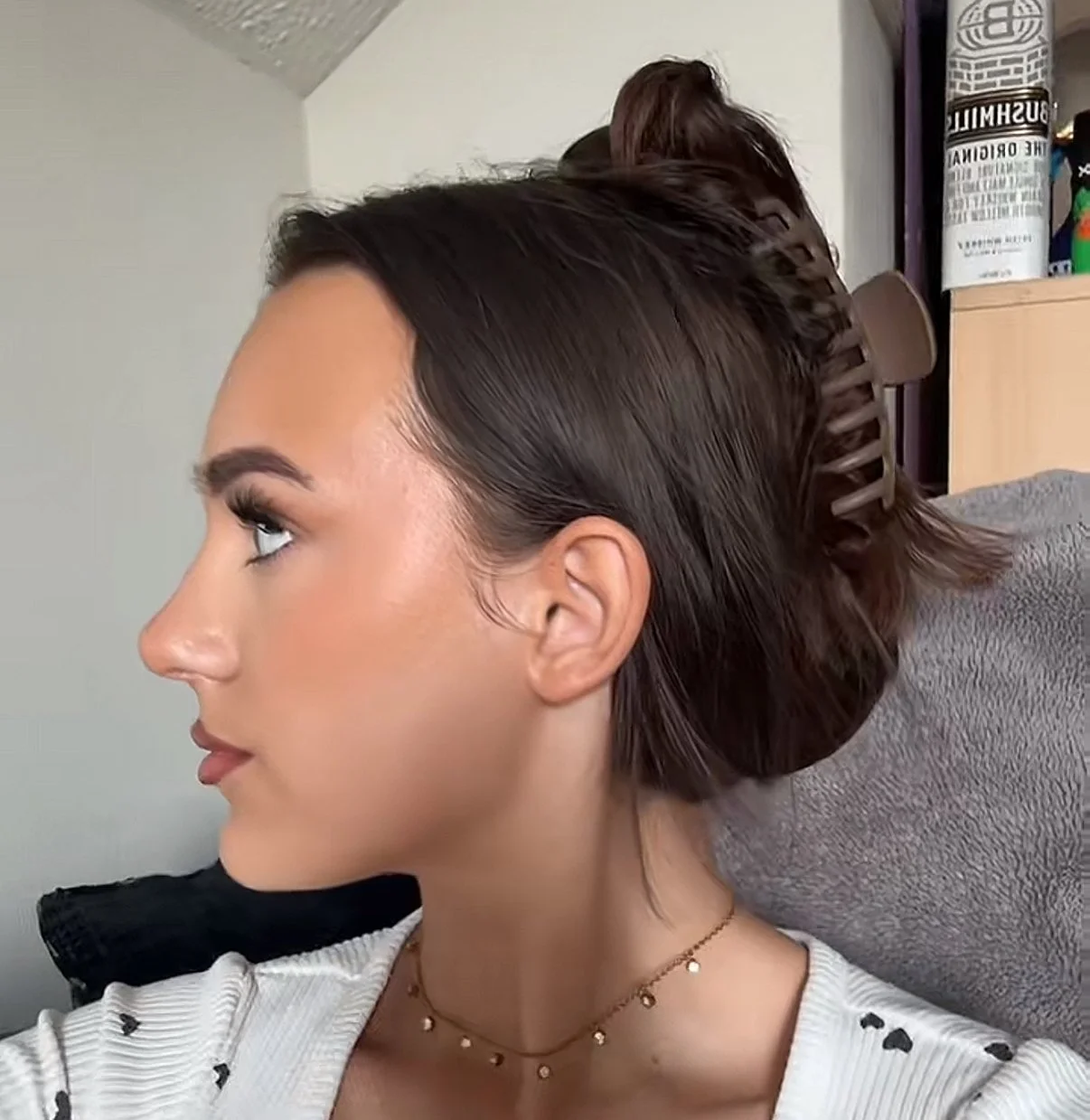 Before and after primary rhinoplasty revision rhinoplasty in Istanbul