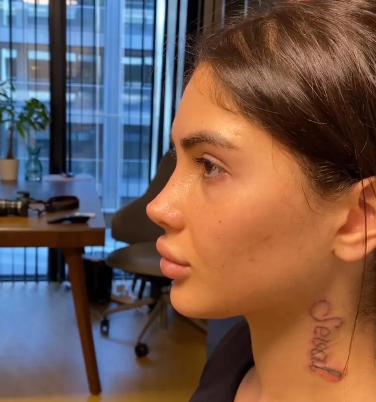 Natural Rhinoplasty vs. Barbie Nose: What’s the Difference?