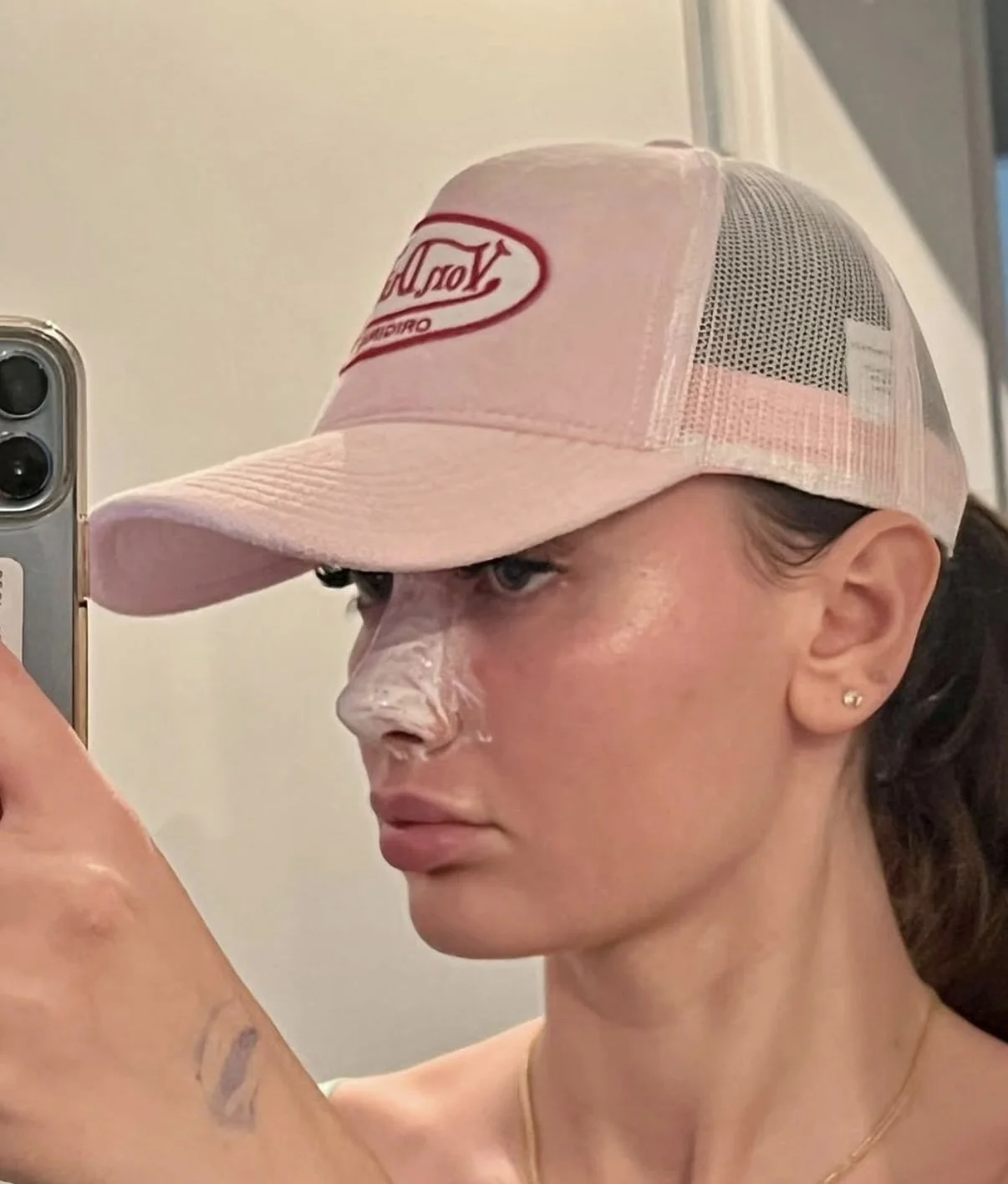 7 Common Mistakes Patients Make During Rhinoplasty Recovery