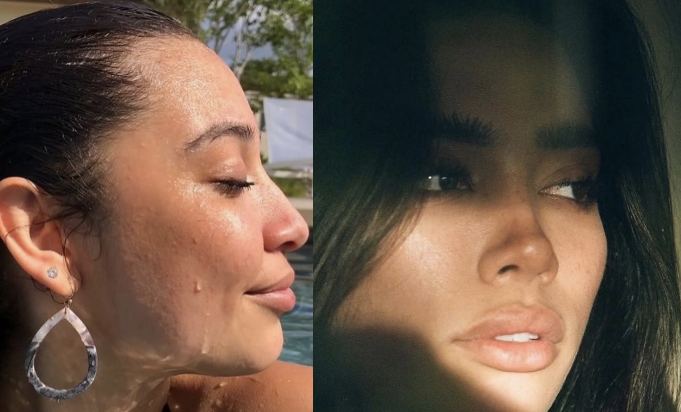 Primary rhinoplasty consultation in Istanbul