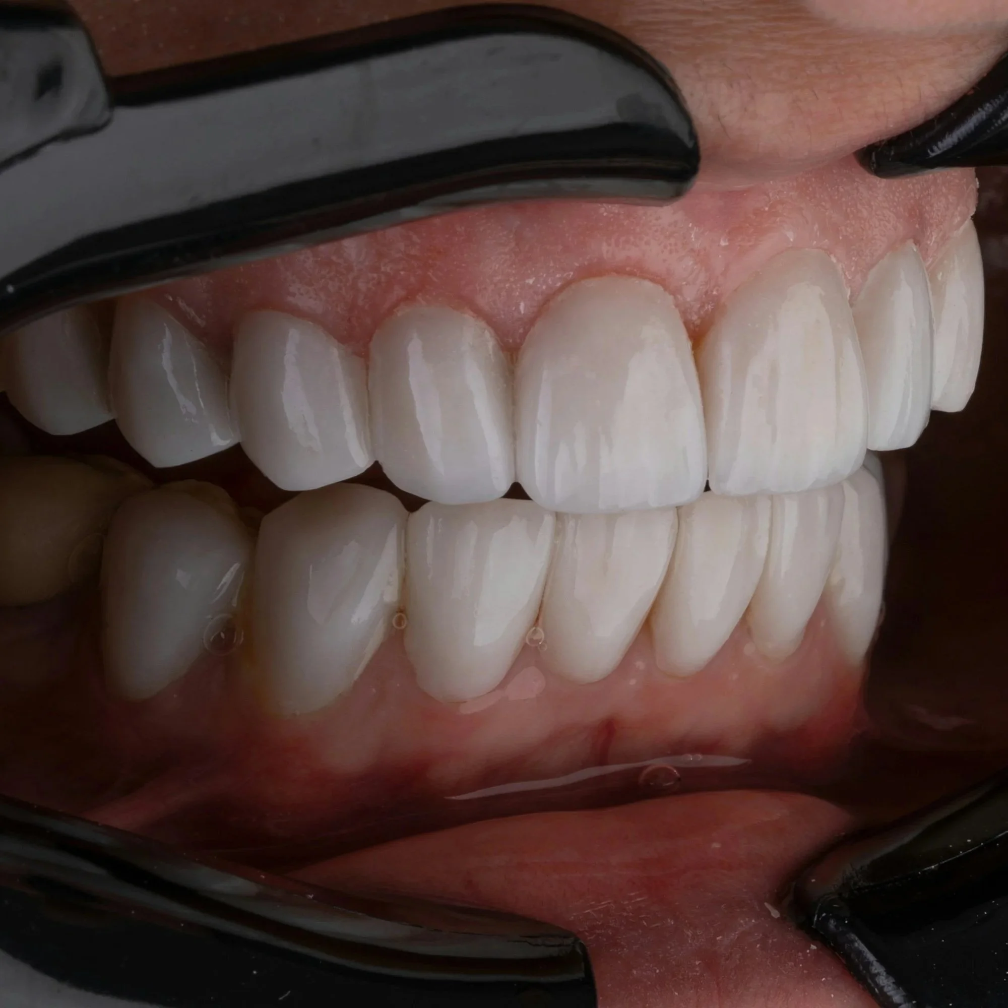 Advanced Implant Specialists