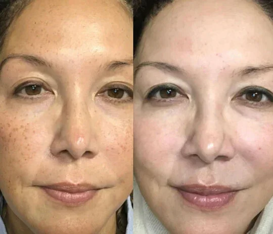 Anti-Wrinkles