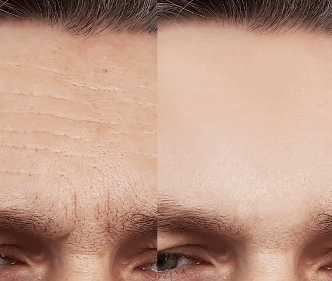 Fine Lines