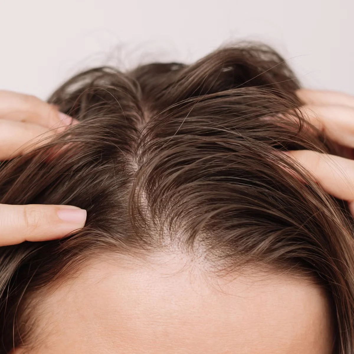 Weakened Scalp Health & Fine Strands