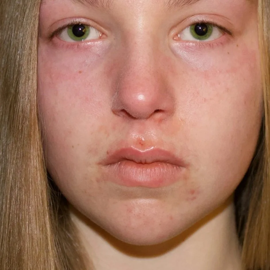 Weak Chin Projection