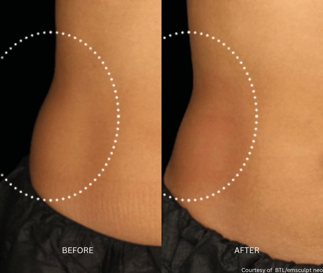 Body Transformation
