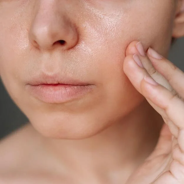 Dull & Lackluster Skin