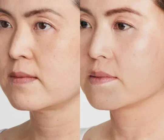 Anti-Wrinkles
