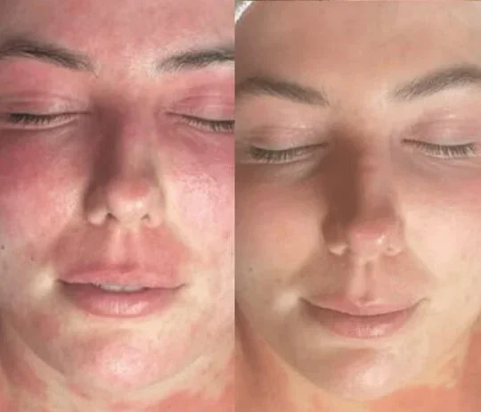 Anti-Wrinkles