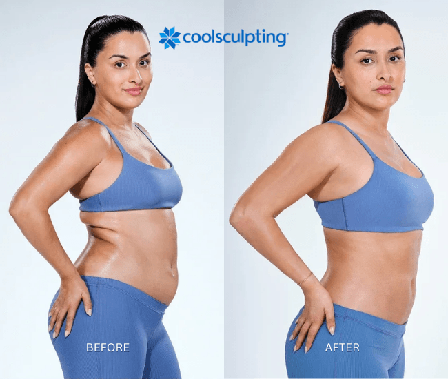 Body Transformation