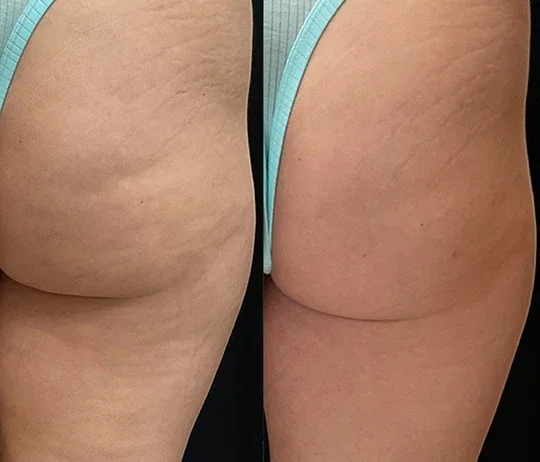 Body Transformation