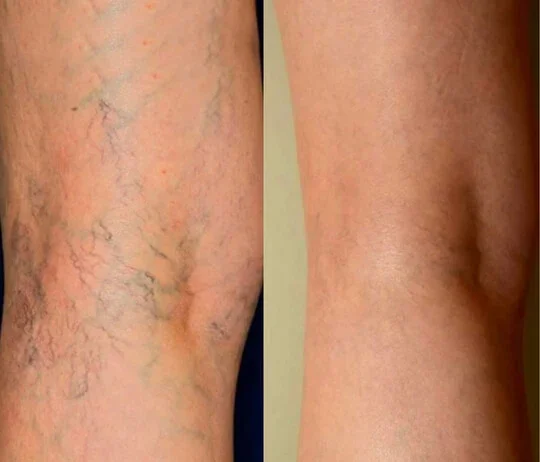 Body Transformation