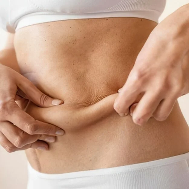 Loose Skin Tightening