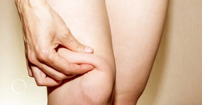 Peripatellar & Above-Knee Drooping