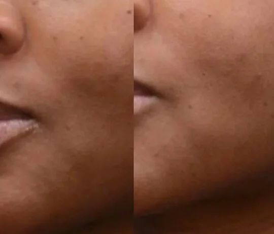 Fine Lines