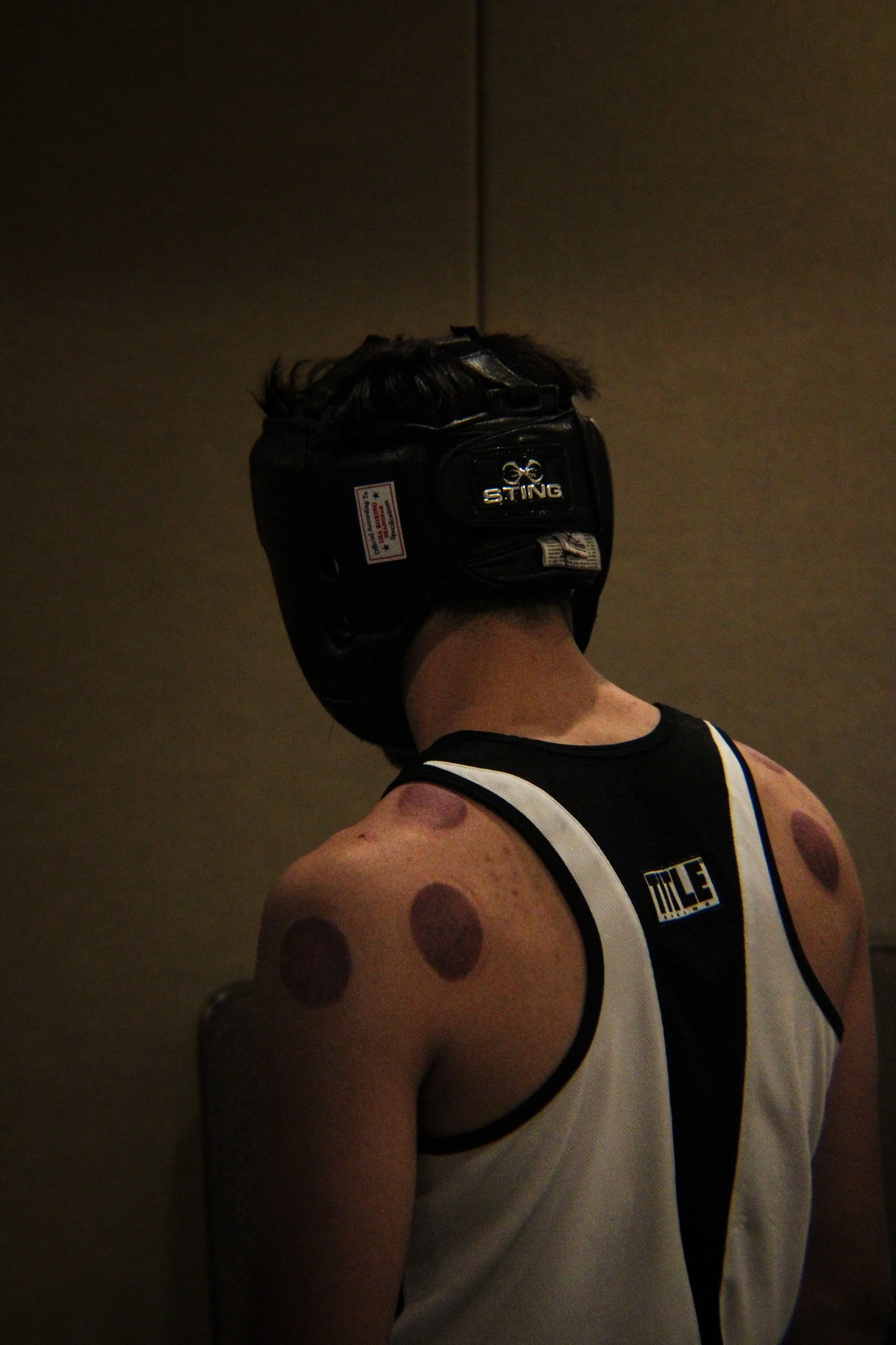 A person wearing a white sports jersey with black trim, a black headgear labeled 'Sting', and playing arm guard, with prominent large reddish-brown spots on their skin.