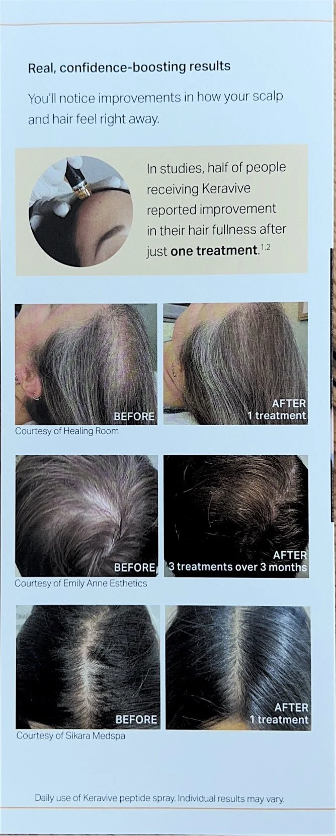 Hydrafacial Keravive Brochure Results.jpg