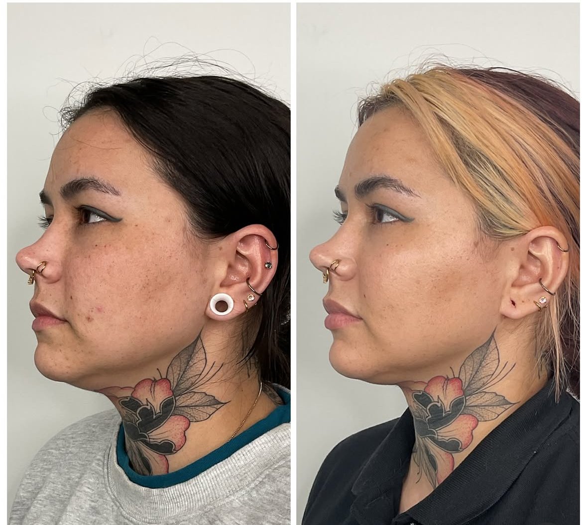 Side-by-side comparison of a woman before and after cosmetic treatment, with visible changes in skin texture and makeup, featuring a floral tattoo on her neck and multiple earrings.