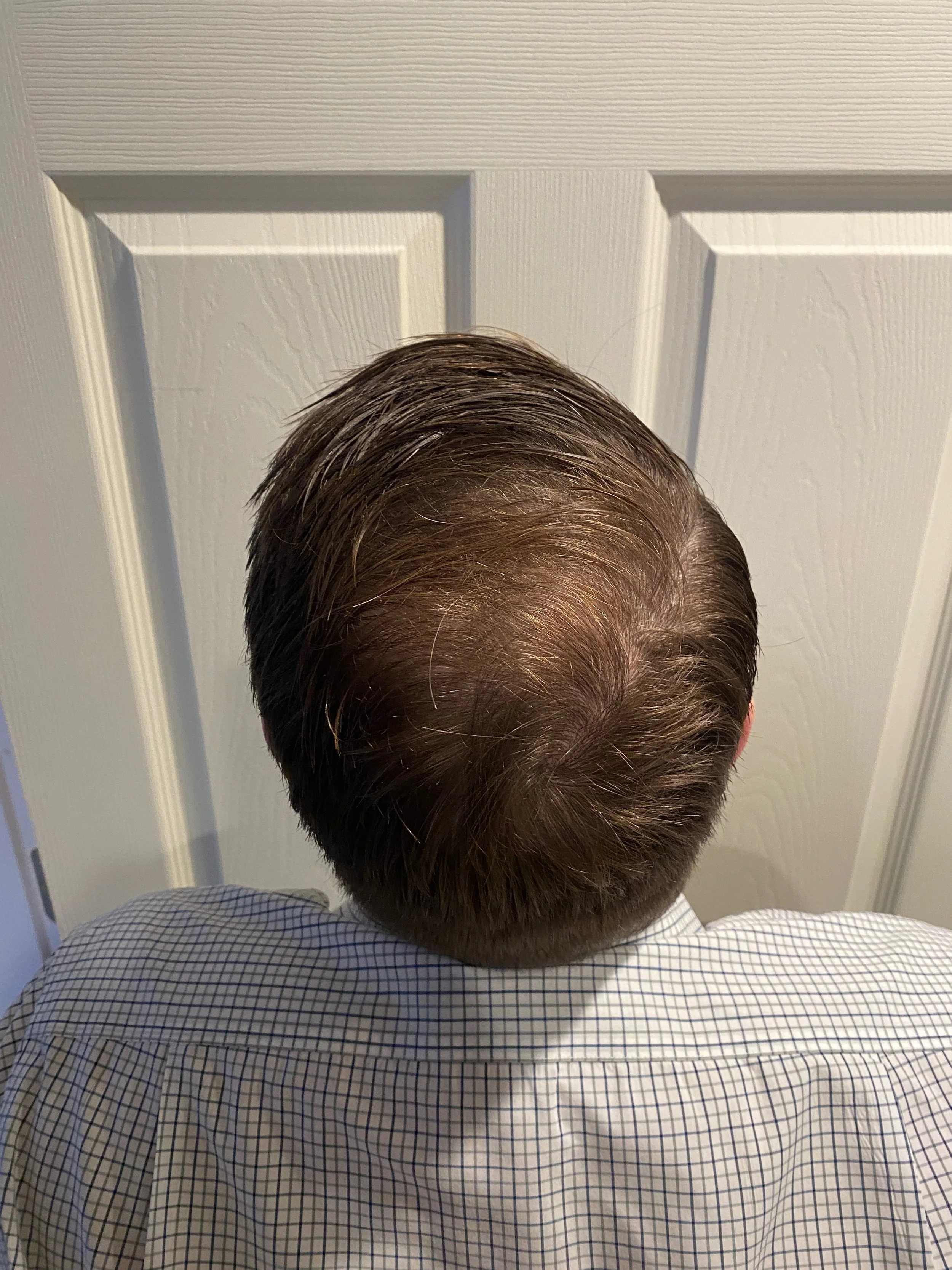 Top view of a man's head with brown hair, seen from behind, wearing a checked shirt.