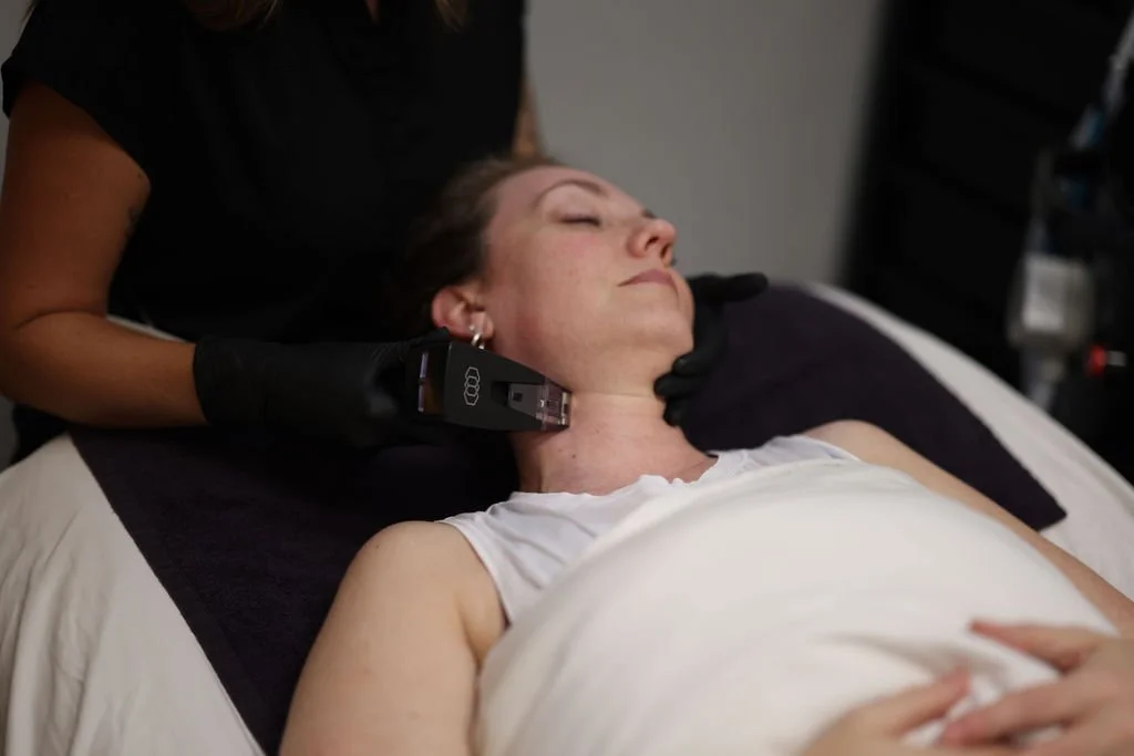 A woman is lying down on a bed with her eyes closed, receiving a morpheus8 treatment with a handheld device on her neck, while a practitioner wearing black gloves is operating the device.