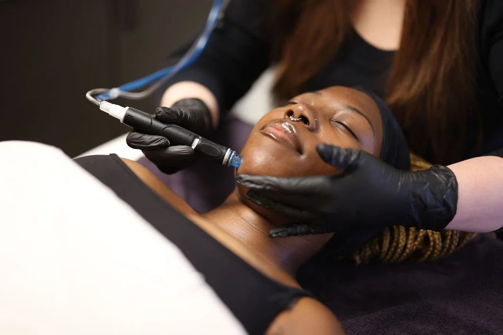A woman receives a hydrafacial treatment with a facial roller and a professional applying a cosmetic procedure on her face.