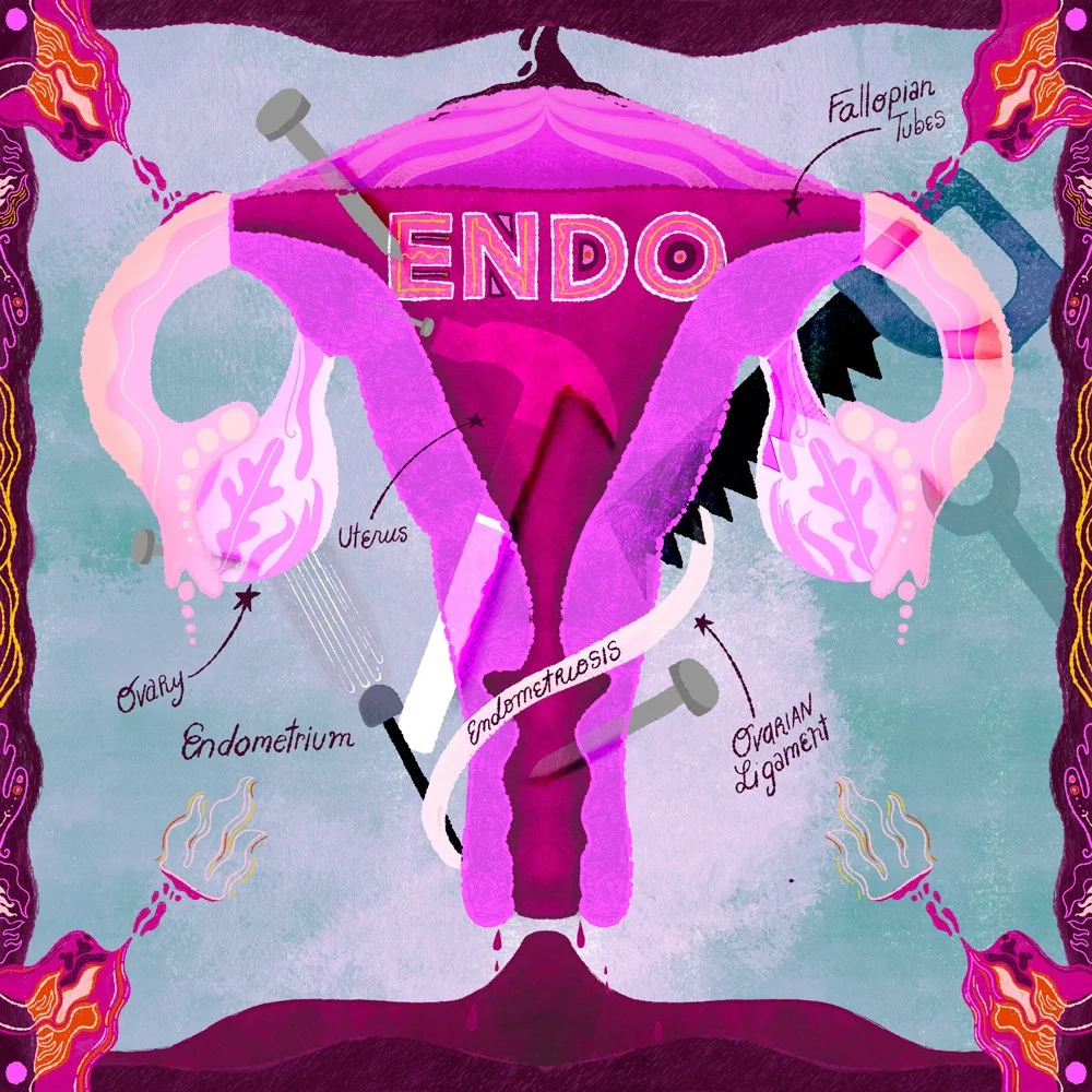 TamishaHarris_Endometriosis_Editorial_Illustration_Medical_Illustration.jpg