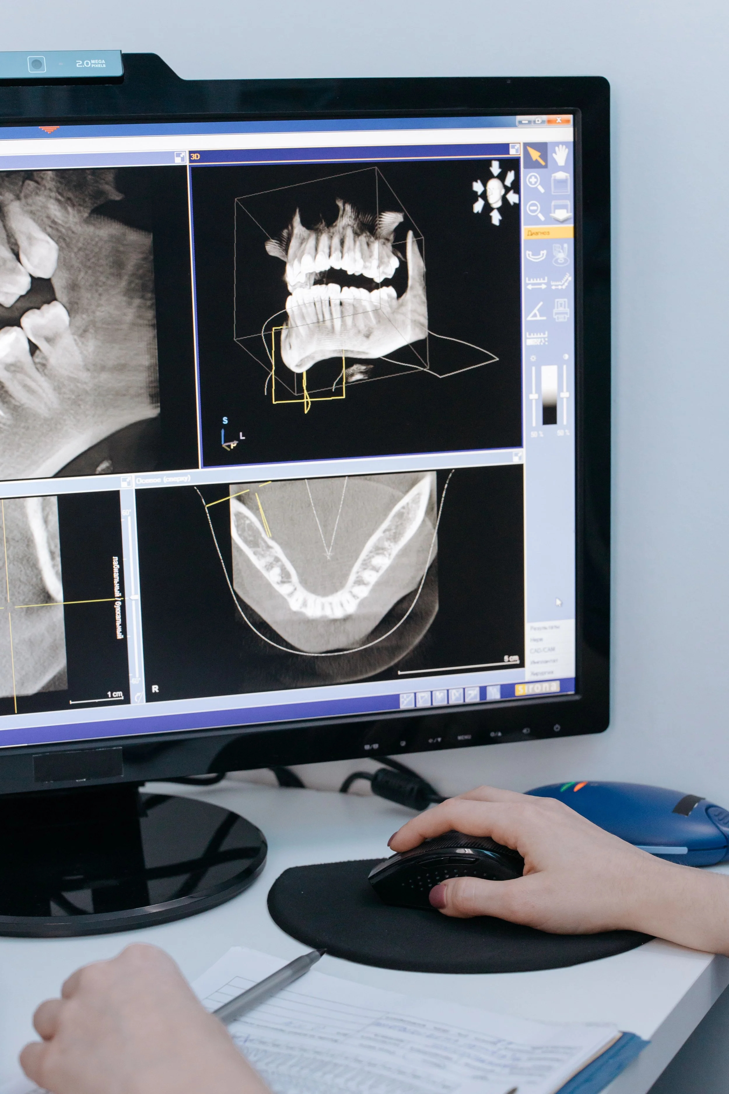 A computer monitor displaying a 3D dental scan of a person's teeth and jaw. A person's hand is on a computer mouse, and another hand is taking notes on a notebook on the desk.