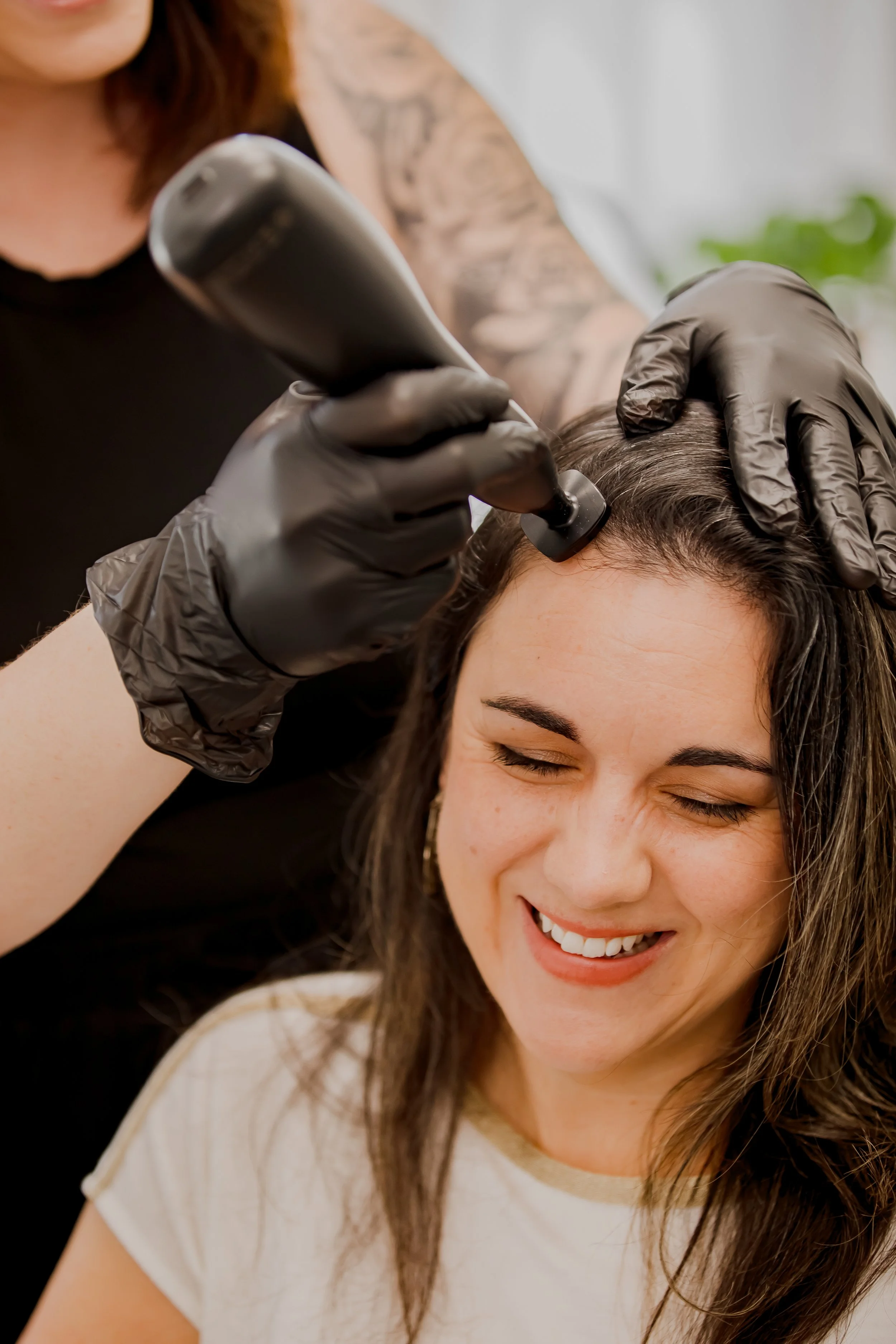 Hands of a hair loss specialist performing an Ozone Plasma Therapy treatment supporting scalp health and healthy hair growth in Phoenix, Arizona.