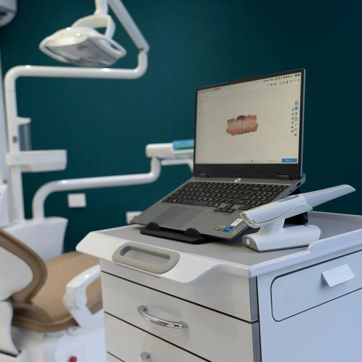 Computadora con scanner intraoral