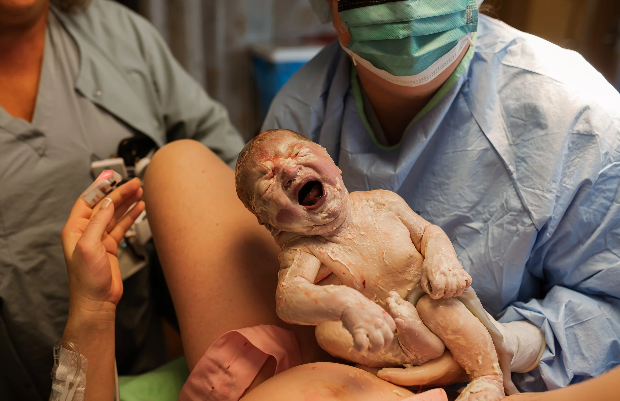 Birth Photography