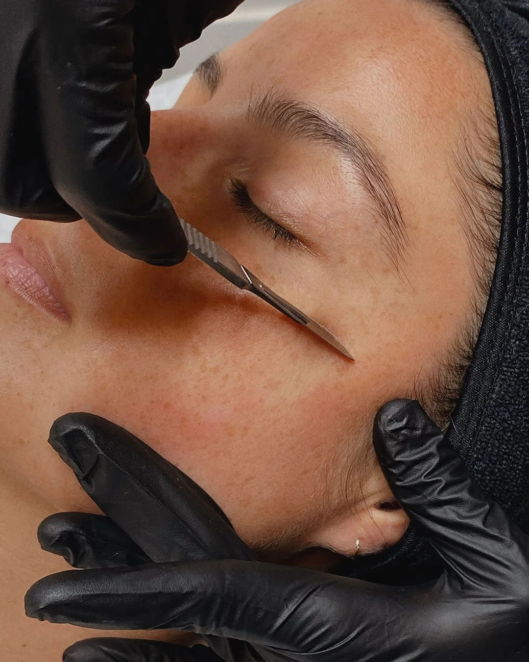 Dermaplaning Is More Than Just Removing Peach Fuzz