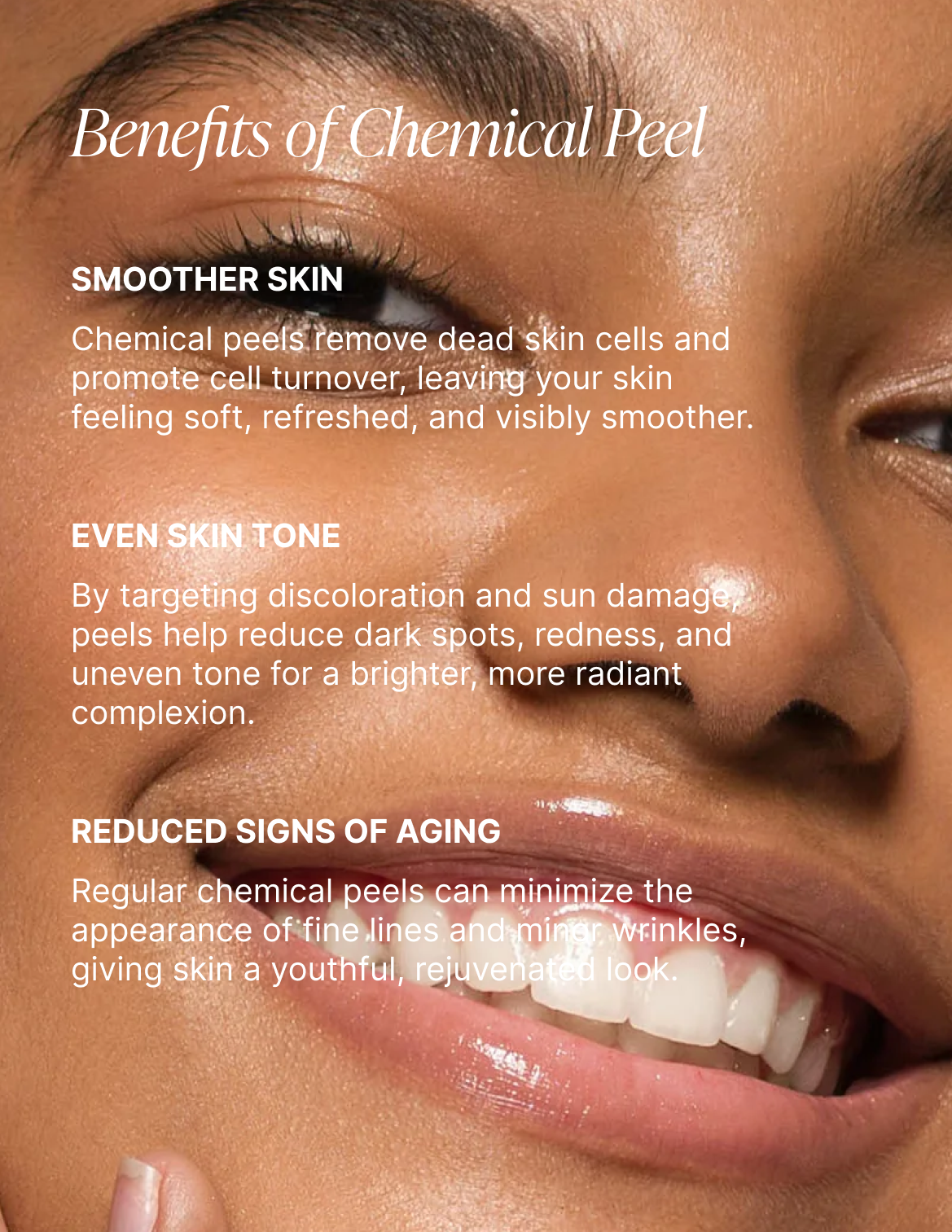 Close-up of a woman's smiling face with text overlay explaining the benefits of chemical peel skincare treatments, including smoother skin, even skin tone, and reduced signs of aging.