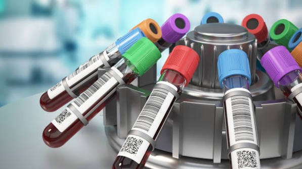 Test tubes with blood samples in a laboratory rack, with colorful caps, nearby to a centrifuge.