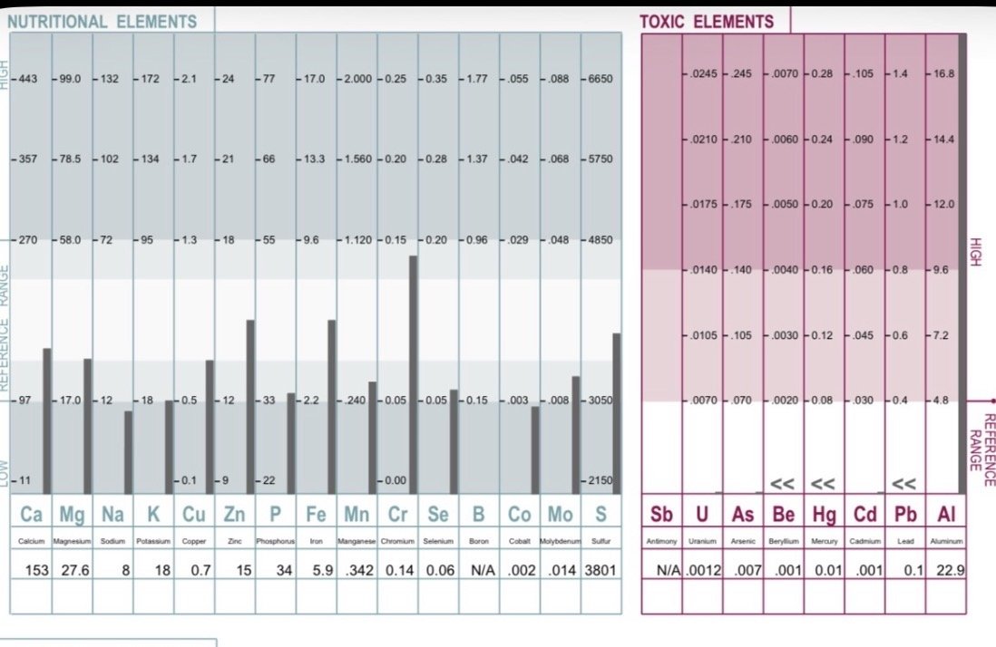Consult with MMMT Test,  Interpretation, and personalized diet plan