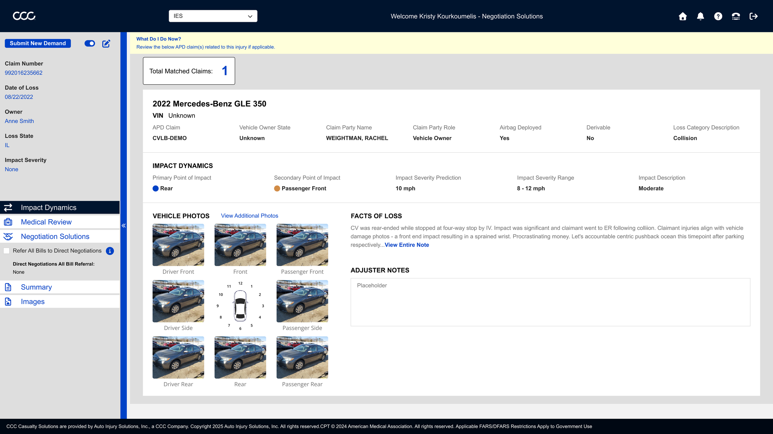 Screenshot of an online car insurance claim webpage showing vehicle injury details, photos, and claim information for a 2022 Mercedes-Benz GLE 350.