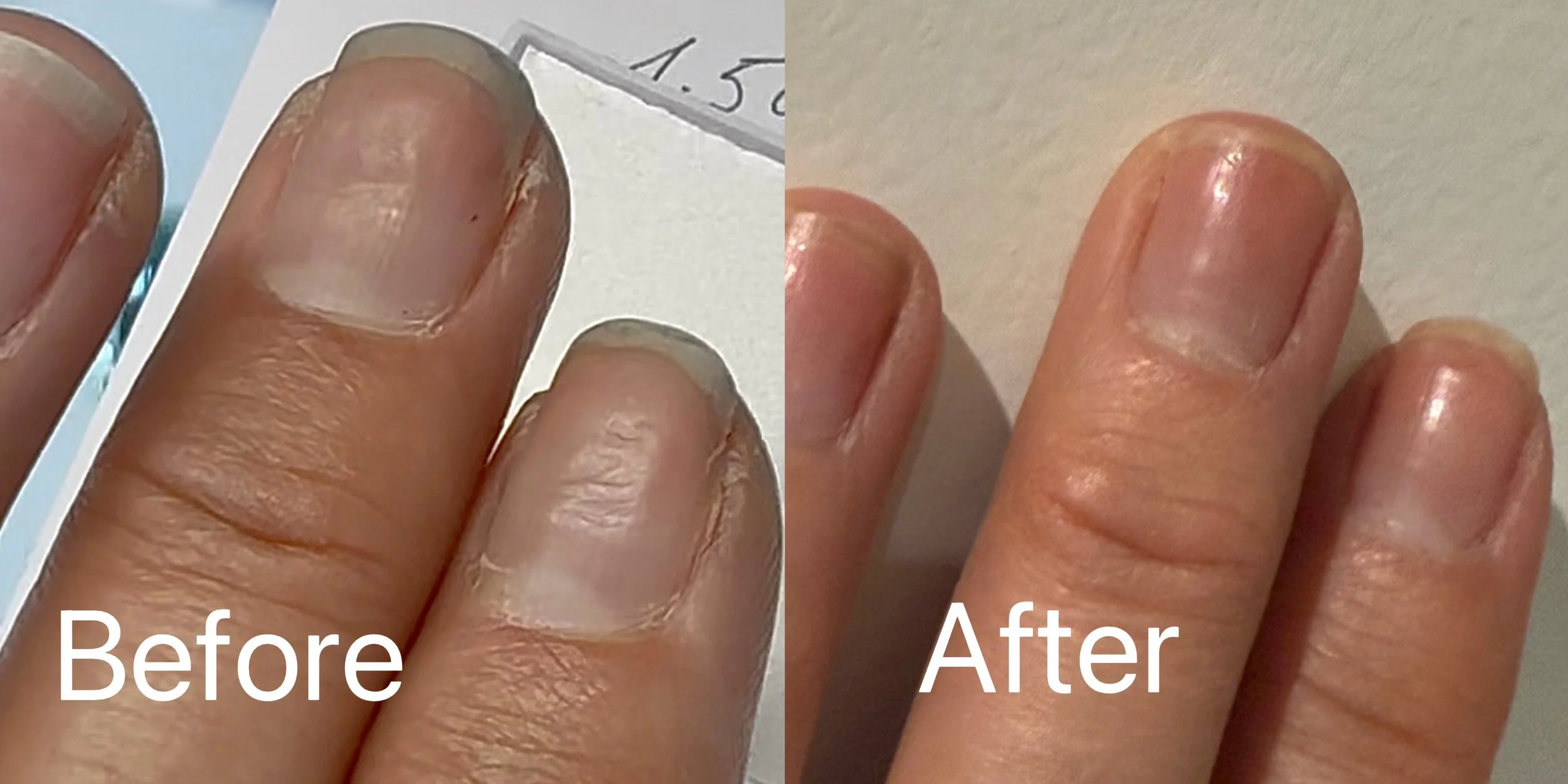HAND BEFORE AND AFTER.jpg