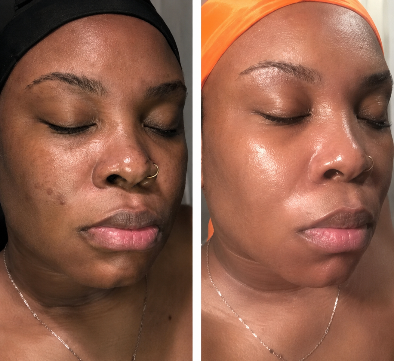 Side-by-side comparison of a woman's face showing before and after skincare or makeup application, with clear, glowing skin in the after photo. Complexion code in atlanta, ga