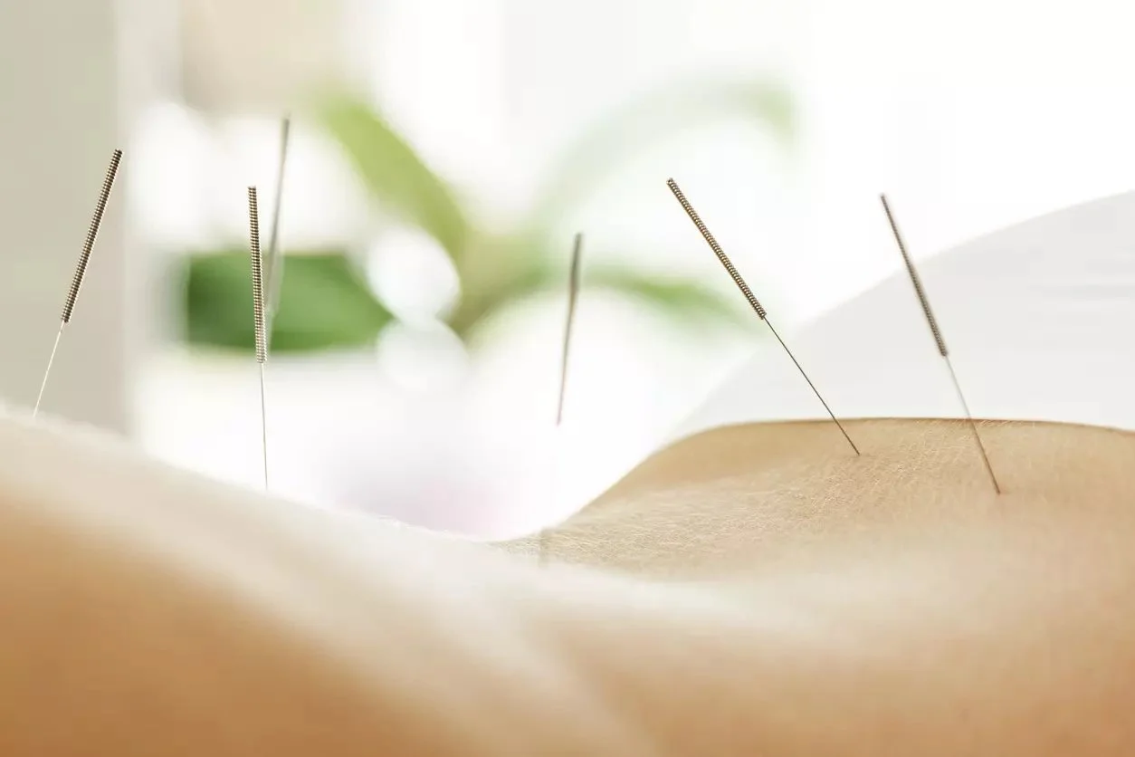 Nest Clinic Acupuncture