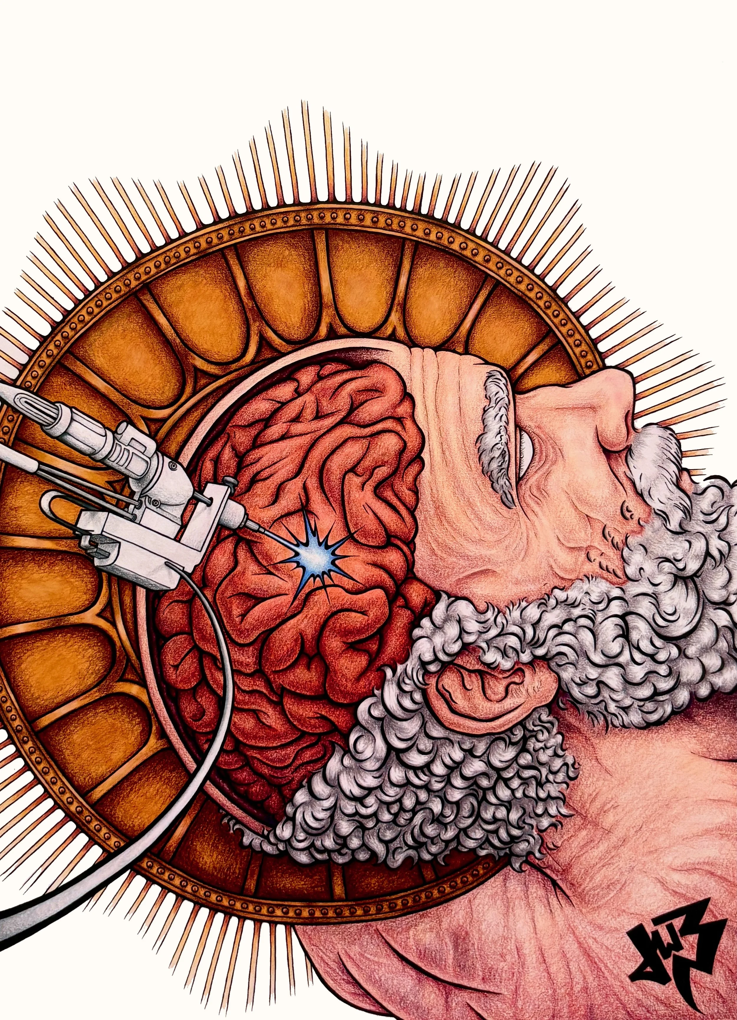 Minimally Invasive (2026)
