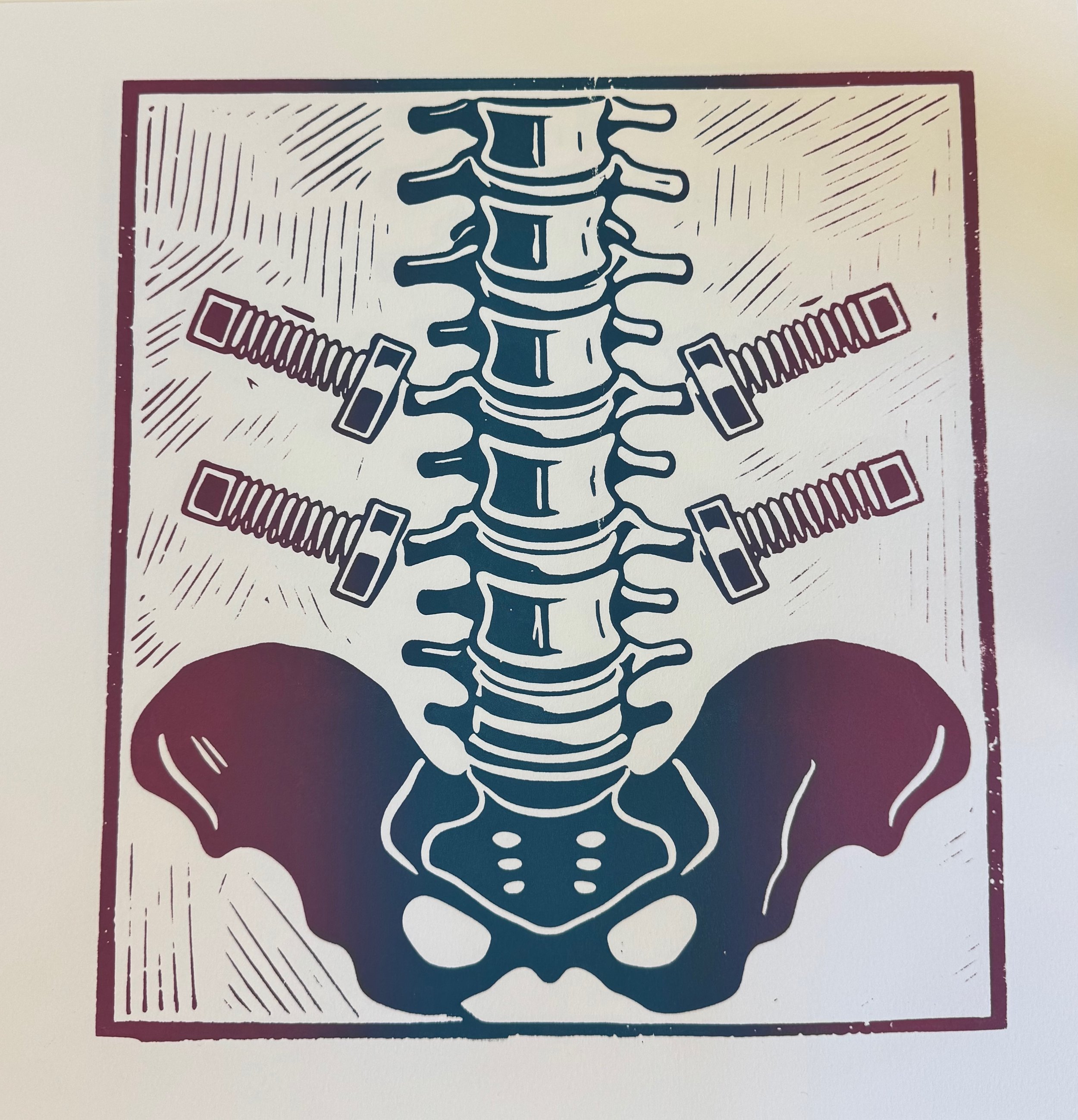 dual tone screen print Spring 2025