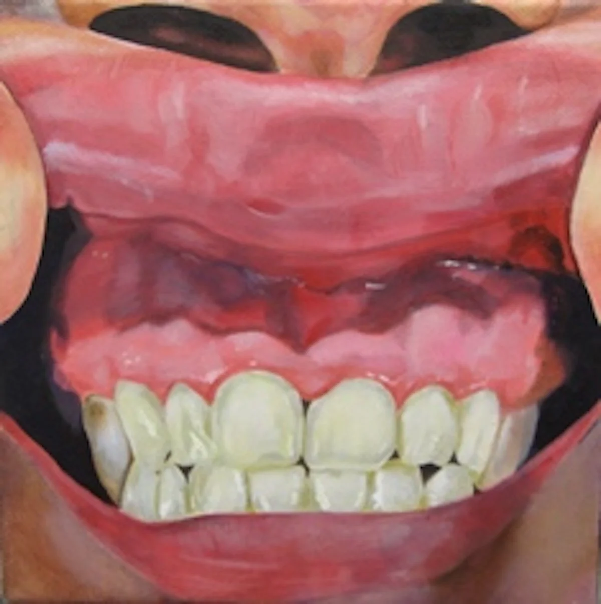 Close-up view of a painting of a mouth with the upper lip pulled back to reveal teeth and gums.