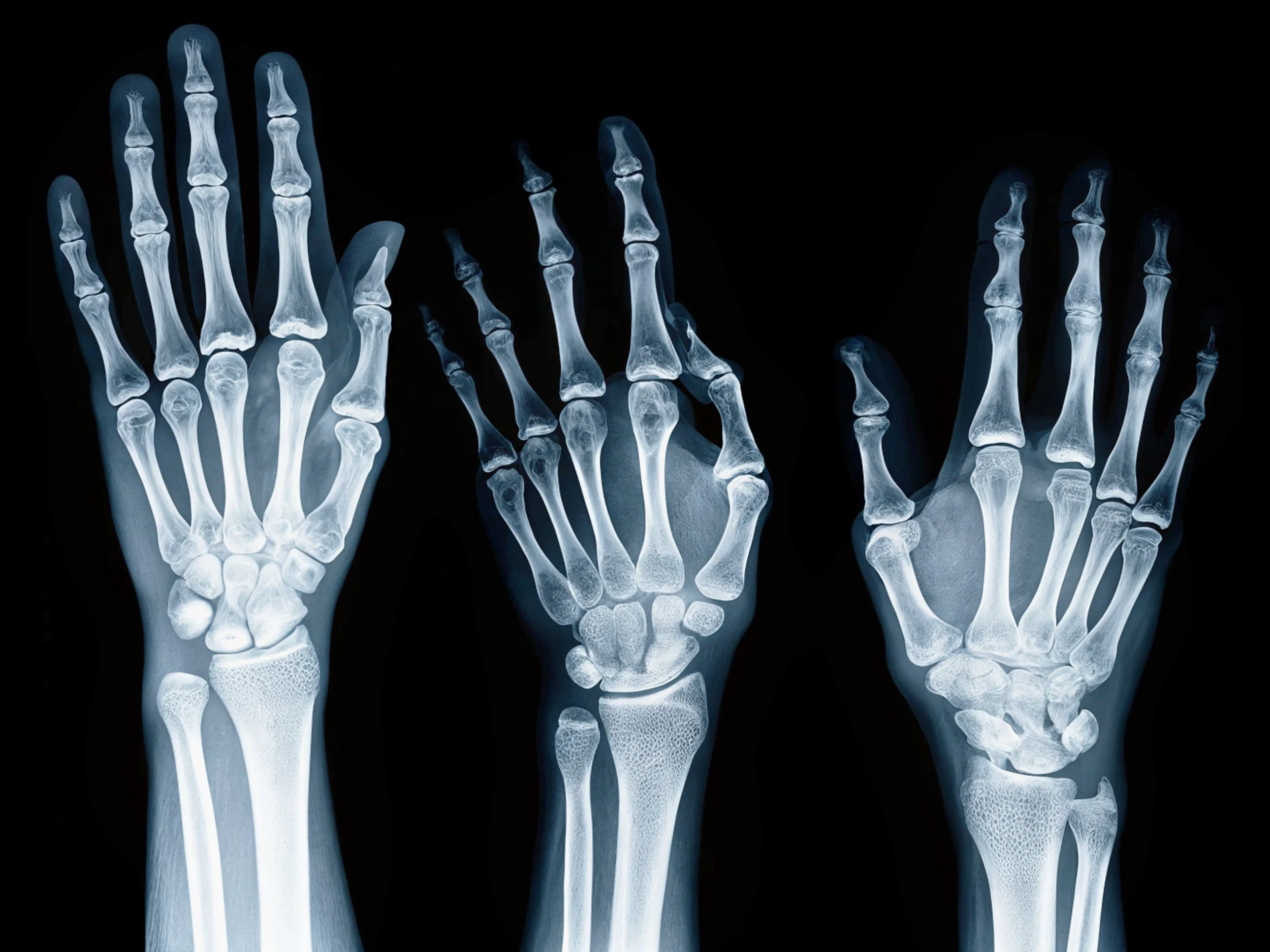 AIM-HYPER-XRAY-VARIATIONS-3.jpg