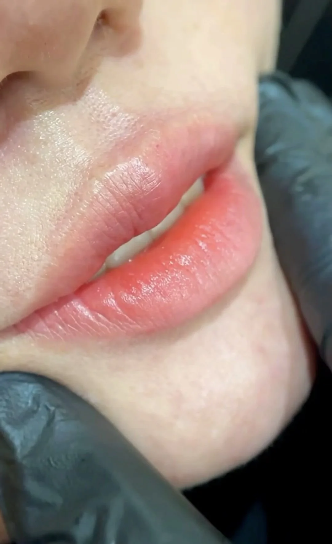 Close-up of a person's lips, showing a slightly chapped, pinkish appearance. The person has light skin, and the photo captures part of their face, including the nose and cheek.